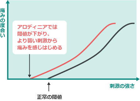 片頭痛の有病率